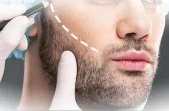 Волосы растут там, где хочется: всё о пересадке бороды