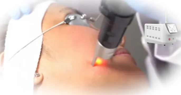 Процедура пикосекундного лазерного омоложения