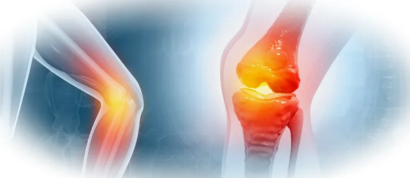 Почему важно вовремя лечить воспаления суставов