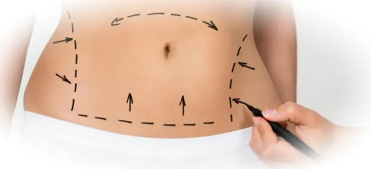 Преимущества Vaser-липосакции