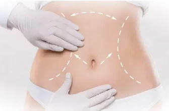 Vaser-липосакция: описание метода, преимущества