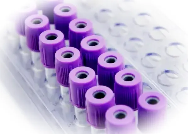 Какими должны быть качественные пробирки