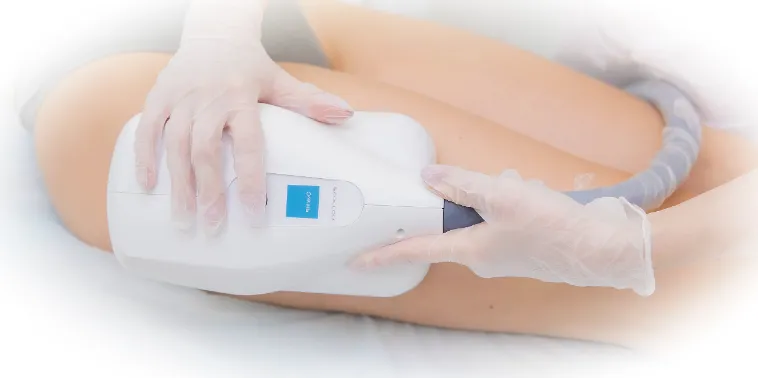 Криолиполиз