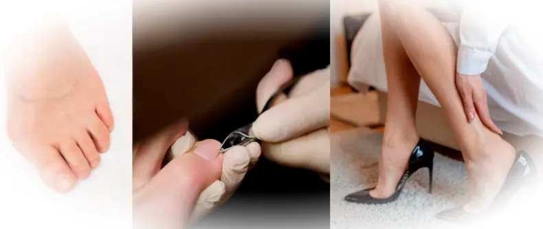 Проблемы стопы и пальцев