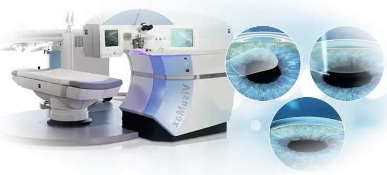 Как проходит операция SuperLASIK