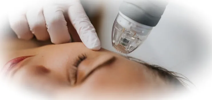 Преимущества РФ‑лифтинга