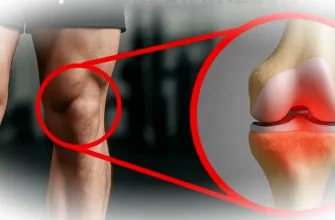 Резекция мениска