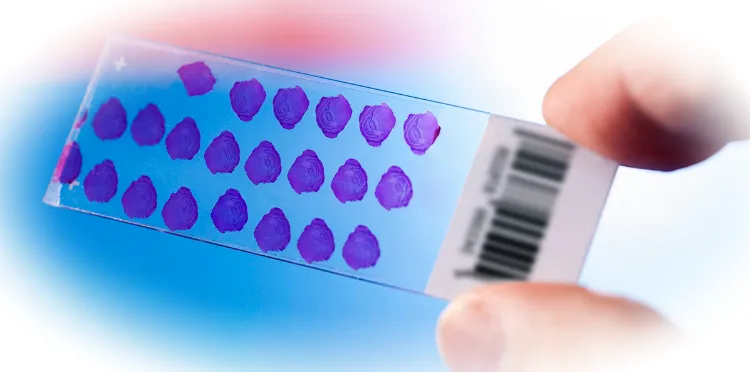 Нормы содержания гемоглобина и эритроцитов