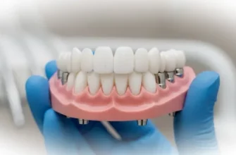 Базальная имплантация зубов: этапы, показания, сроки восстановления