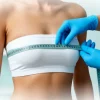 Уменьшение груди: показания, ход операции и сроки реабилитации