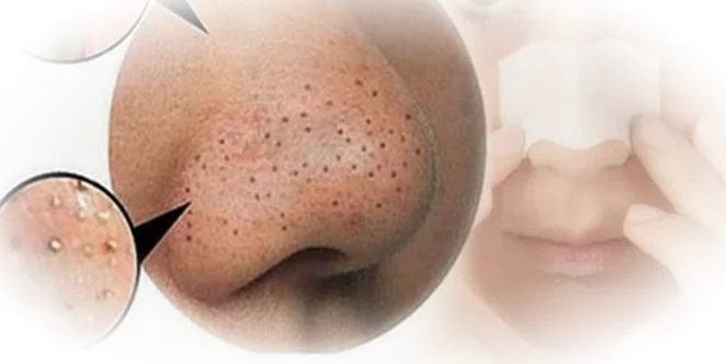 С чего начать домашнее очищение?